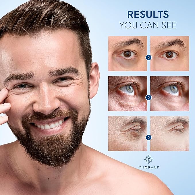 MEN'S EXPERT ANTI OJERAS - DESPIGMENTANTE ACLARADOR